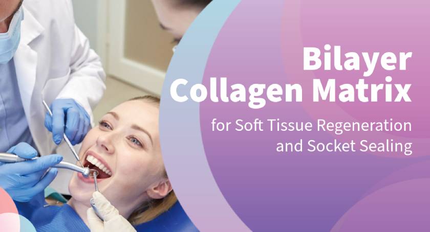 Bilayer Collagen Matrix for Soft Tissue Regeneration and Socket Sealing
